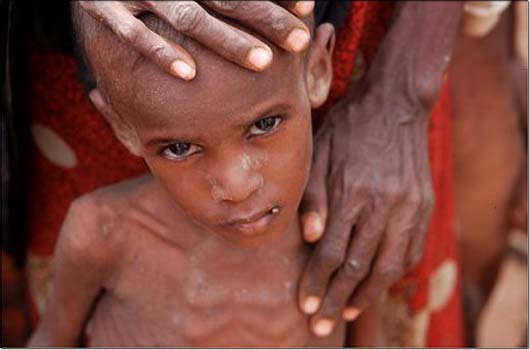 Kind in �thiopien